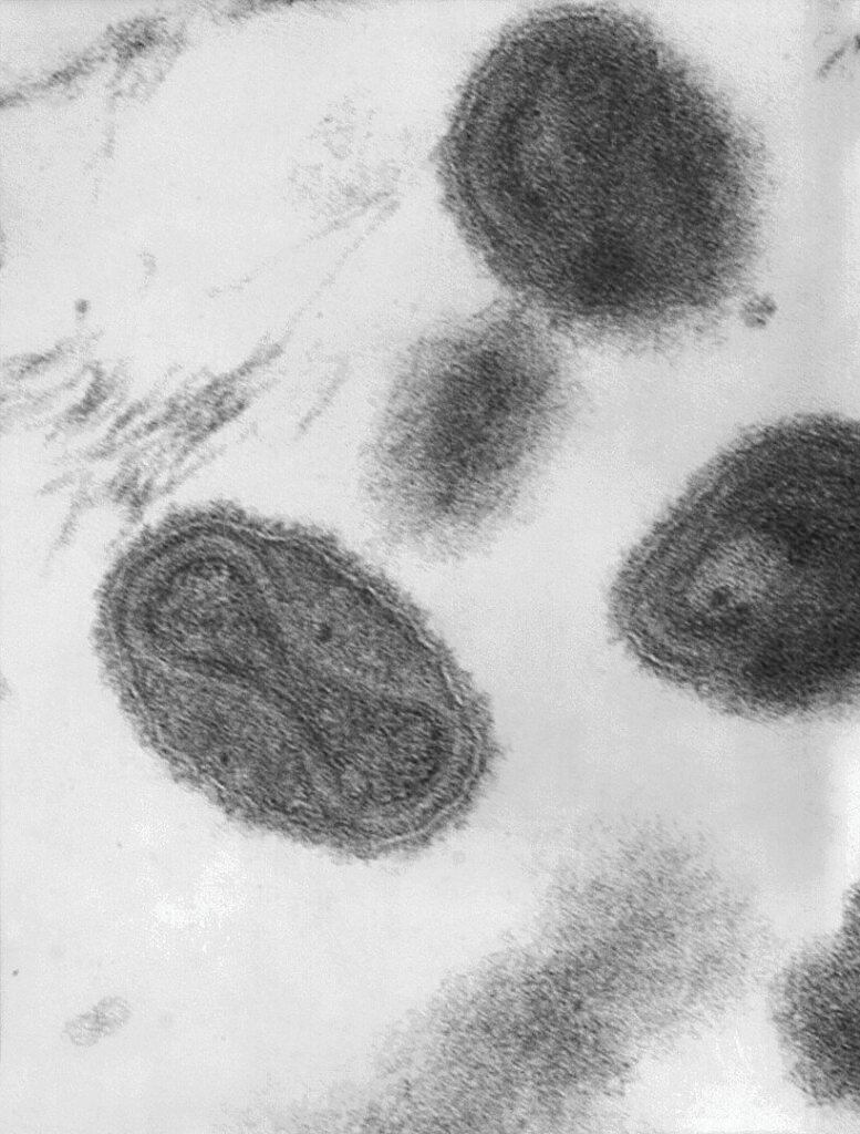smallpox virions under transmission electron microscope